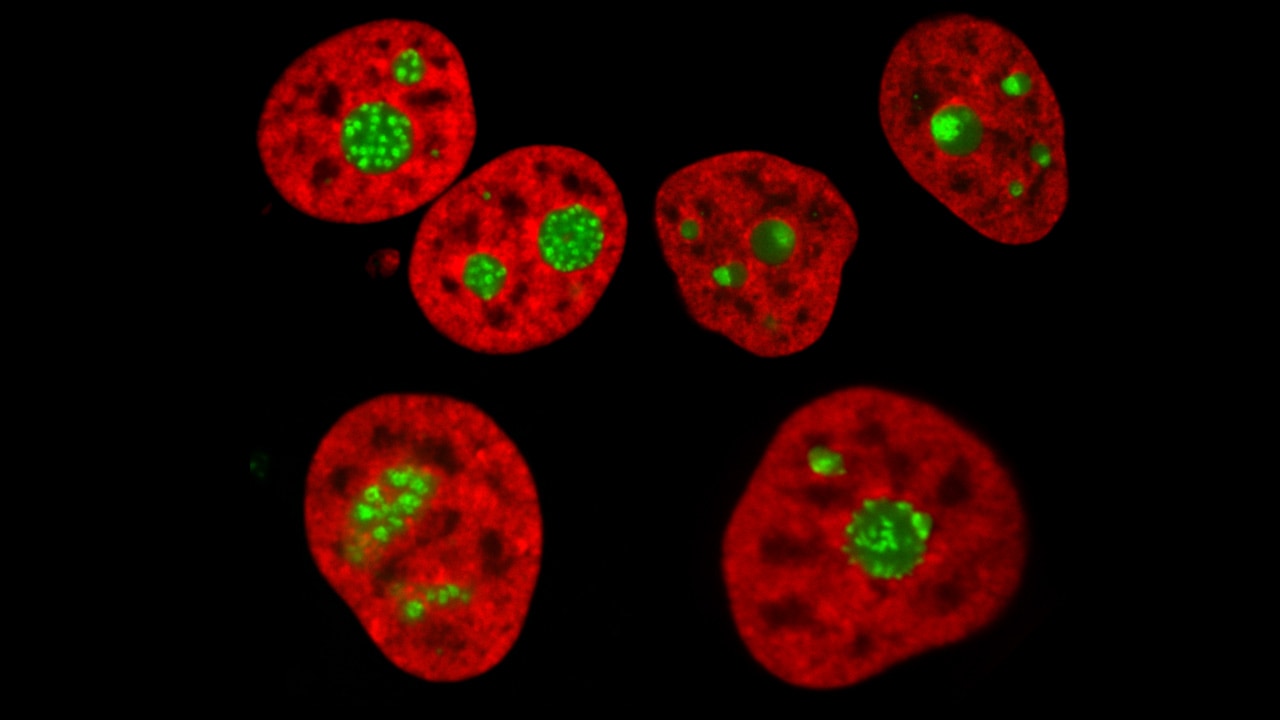 Understanding Human Nucleolar Structure